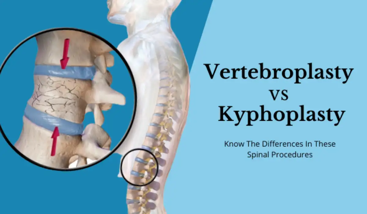 Kyphoplasty vs Vertebroplasty