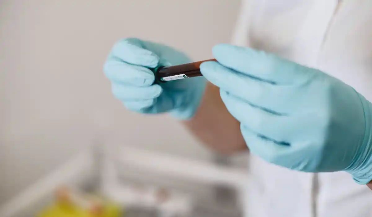 Non-HDL Cholesterol: Levels, Risks and How to Lower It