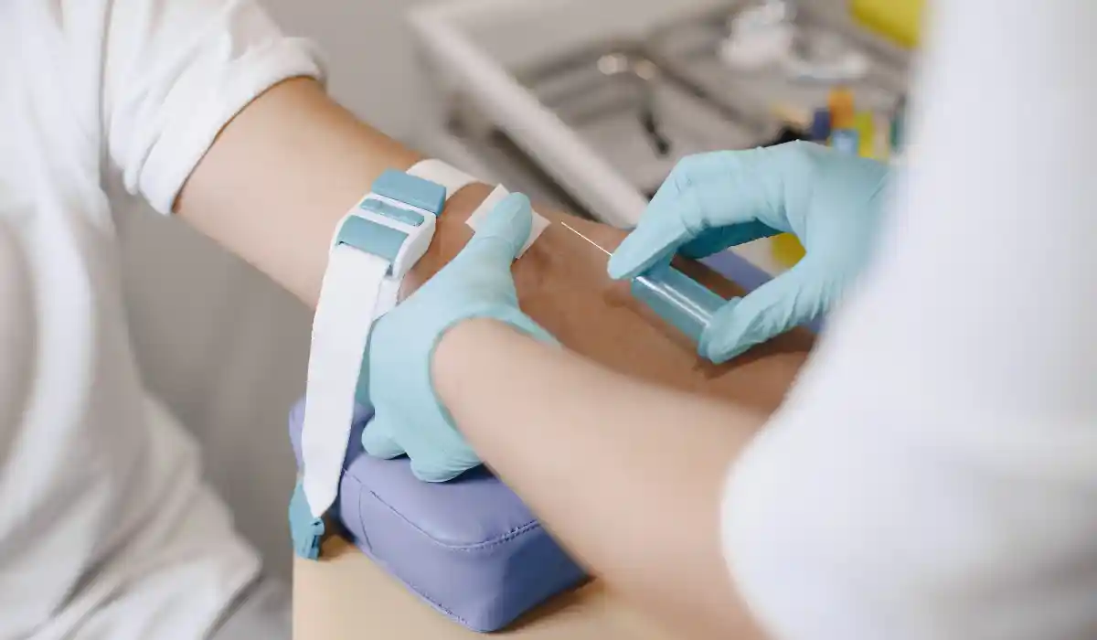 Things to Avoid Prior to PSA Test for Accurate Results