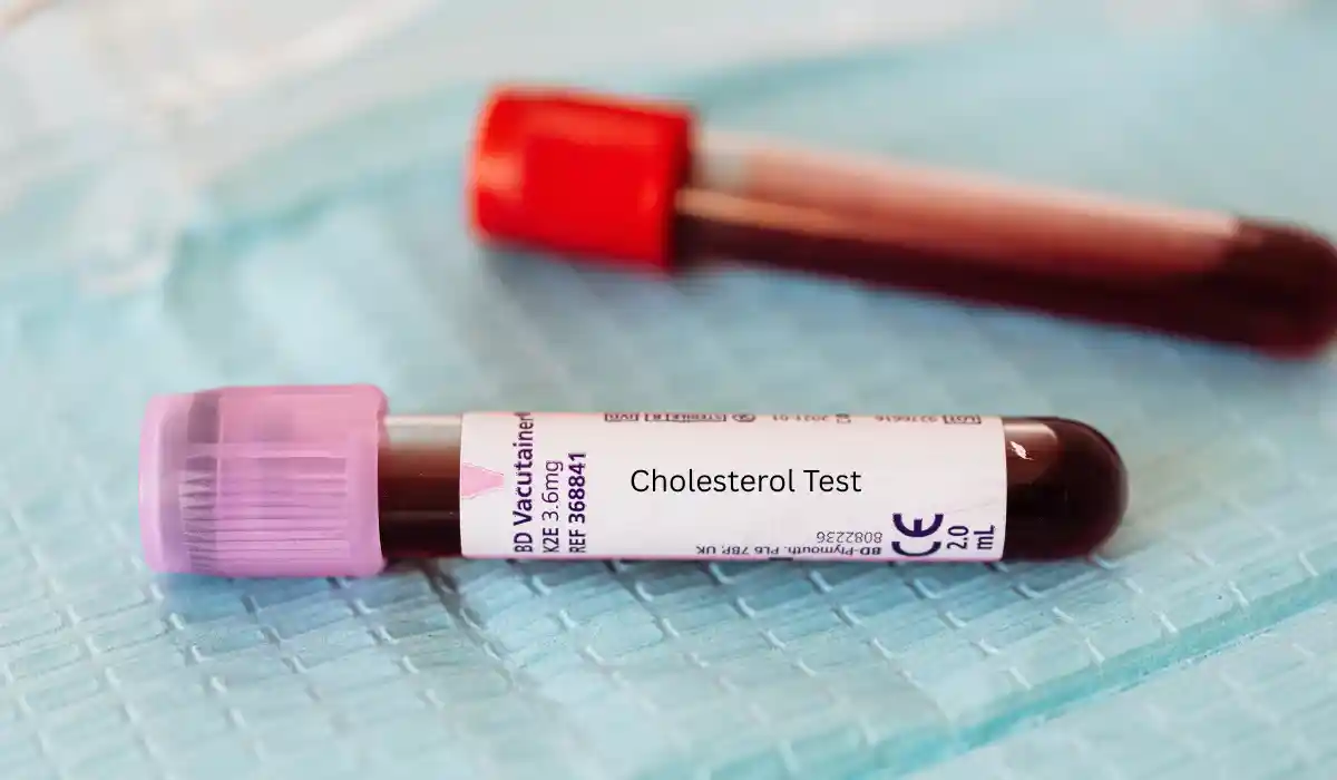 Total Cholesterol Normal Range and What It Means