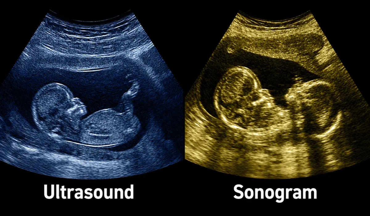 Sonogram vs Ultrasound: Uses, Benefits, And Differences
