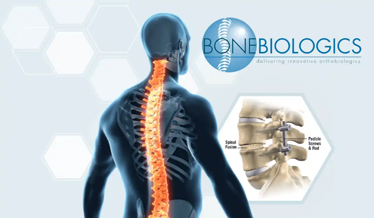 Bone Biologics Secures $3.0 Million Through Private Placement With Institutional Investor