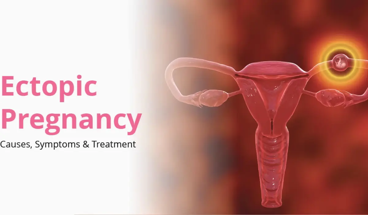 When Do Ectopic Pregnancy Symptoms Start? A Week-By-Week Guide